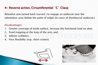 Rpd  direct retainers 2nd yr