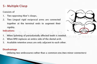 Rpd  direct retainers 2nd yr