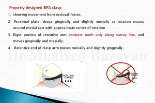 Rpd  direct retainers 2nd yr