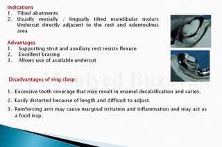 Rpd  direct retainers 2nd yr