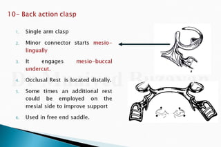 Rpd  direct retainers 2nd yr