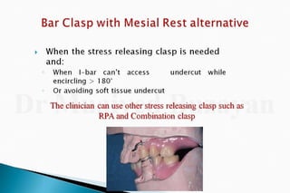 Rpd  direct retainers 2nd yr