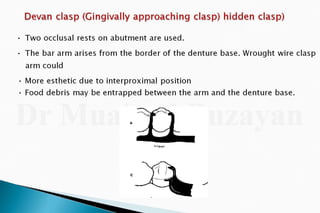 Rpd  direct retainers 2nd yr