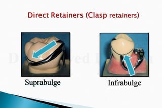 Rpd  direct retainers 2nd yr