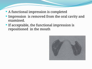 IMPRESSION TECHNIQUES IN REMIVABLE PARTIAL DENTURE | PPTX