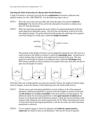 Surveying, Path of Insertion, Guiding Planes - 16
Selecting the Path of Insertion of a Removable Partial Denture
A path of insertion is selected to provide the best combination of retentive undercuts and
parallel surfaces for ALL ABUTMENTS. Use the following steps to do so:
STEP 1 Place the cast on the surveyor table and orient the plane of occlusion relatively
horizontal. The final tilt of the cast for the ideal path of insertion is seldom more
than 10° from this position.
STEP 2 Place the analyzing rod against the axial surface of a proposed abutment teeth (any
tooth adjacent an edentulous space). The tip of the rod should be at the level of the
free gingival margin. The point where the tooth touches the analyzing rod is greatest
convexity (bulge) of a tooth and is called the height of contour.
The position of the height of contour can be changed by tilting the cast. The area on a
tooth occlusal to the height of contour is called the suprabulge area. All portions of
a direct retainer that are rigid or semi-rigid must be located in this area. The area
gingival to the height of contour is an undercut and is called the infrabulge area.
The retentive portions of direct retainers are located in this area, since they can flex to
pass over the height of contour.
Note that when cast is tilted and the surveying arm remains vertical, the height of contour (large
arrows) changes, as does the distance of the analyzing rod to the tooth (small arrows)
STEP 3 Tilt the cast to gain maximum parallelism of axial surfaces of all of the proposed
abutments. Maximum parallelism is present when the heights of contour of all teeth
and all surfaces are as close as possible to the same position occluso-gingival. An
additional check for maximum parallelism is that equal amounts of undercut are
present on all abutments and all abutment surfaces. Check the mesial and distal tooth
surfaces while tilting the cast anterior-posteriorly (A-P). While maintaining the same
A-P tilt check facial and lingual parallelism. Lock the tilt of the cast when maximum
parallelism is achieved.
STEP 4 Use an undercut gauge to check for adequate and relatively equal retentive,
undercuts for retentive arms on all abutments. Alter the tilt of cast if required.
 