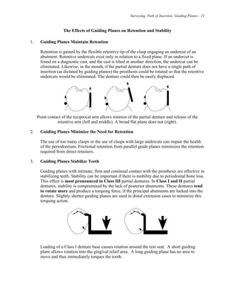 Surveying, Path of Insertion, Guiding Planes - 21
The Effects of Guiding Planes on Retention and Stability
1. Guiding Planes Maintain Retention
Retention is gained by the flexible retentive tip of the clasp engaging an undercut of an
abutment. Retentive undercuts exist only in relation to a fixed plane. If an undercut is
found on a diagnostic cast, and the cast is tilted in another direction, the undercut can be
eliminated. Likewise, in the mouth, if the partial denture does not have a single path of
insertion (as dictated by guiding planes) the prosthesis could be rotated so that the retentive
undercuts would be eliminated. The denture could then be easily displaced.
Point contact of the reciprocal arm allows rotation of the partial denture and release of the
retentive arm (left and middle). A broad flat plane does not (right).
2. Guiding Planes Minimize the Need for Retention
The use of too many clasps or the use of clasps with large undercuts can impair the health
of the periodontium. Frictional retention from parallel guide planes minimizes the retention
required from direct retainers.
3. Guiding Planes Stabilize Teeth
Guiding planes with intimate, firm and continual contact with the prosthesis are effective in
stabilizing teeth. Stability can be important if there is mobility due to periodontal bone loss.
This effect is most pronounced in Class III partial dentures. In Class I and II partial
dentures, stability is compromised by the lack of posterior abutments. These dentures tend
to rotate more and produce a torquing force, if the principal abutments are locked into the
denture. Slightly shorter guiding planes are used in distal extension cases to minimize this
torquing action.
Loading of a Class I denture base causes rotation around the rest seat. A short guiding
plane allows rotation into the gingival relief area. A long guiding plane has no area to
move and thus immediately torques the tooth.
 