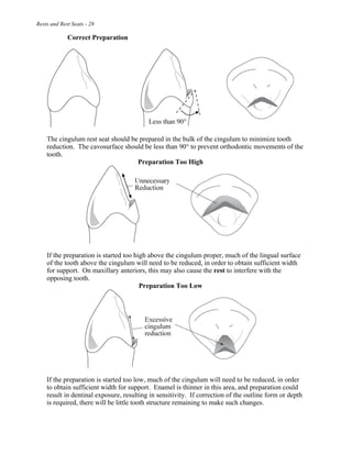 Rests and Rest Seats - 28
Correct Preparation
The cingulum rest seat should be prepared in the bulk of the cingulum to minimize tooth
reduction. The cavosurface should be less than 90° to prevent orthodontic movements of the
tooth.
Preparation Too High
If the preparation is started too high above the cingulum proper, much of the lingual surface
of the tooth above the cingulum will need to be reduced, in order to obtain sufficient width
for support. On maxillary anteriors, this may also cause the rest to interfere with the
opposing tooth.
Preparation Too Low
If the preparation is started too low, much of the cingulum will need to be reduced, in order
to obtain sufficient width for support. Enamel is thinner in this area, and preparation could
result in dentinal exposure, resulting in sensitivity. If correction of the outline form or depth
is required, there will be little tooth structure remaining to make such changes.
 