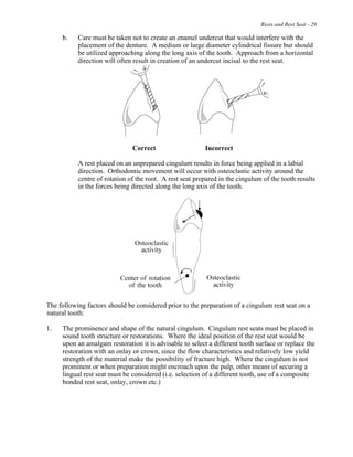 Rests and Rest Seat - 29
b. Care must be taken not to create an enamel undercut that would interfere with the
placement of the denture. A medium or large diameter cylindrical fissure bur should
be utilized approaching along the long axis of the tooth. Approach from a horizontal
direction will often result in creation of an undercut incisal to the rest seat.
Correct Incorrect
A rest placed on an unprepared cingulum results in force being applied in a labial
direction. Orthodontic movement will occur with osteoclastic activity around the
centre of rotation of the root. A rest seat prepared in the cingulum of the tooth results
in the forces being directed along the long axis of the tooth.
The following factors should be considered prior to the preparation of a cingulum rest seat on a
natural tooth:
1. The prominence and shape of the natural cingulum. Cingulum rest seats must be placed in
sound tooth structure or restorations. Where the ideal position of the rest seat would be
upon an amalgam restoration it is advisable to select a different tooth surface or replace the
restoration with an onlay or crown, since the flow characteristics and relatively low yield
strength of the material make the possibility of fracture high. Where the cingulum is not
prominent or when preparation might encroach upon the pulp, other means of securing a
lingual rest seat must be considered (i.e. selection of a different tooth, use of a composite
bonded rest seat, onlay, crown etc.)
 