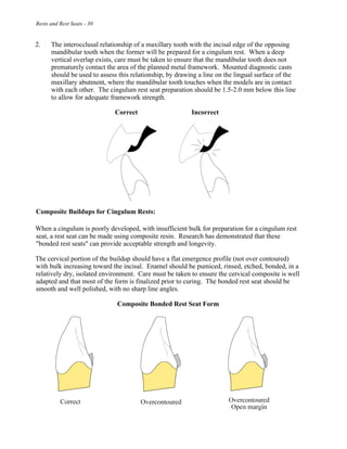 Rests and Rest Seats - 30
2. The interocclusal relationship of a maxillary tooth with the incisal edge of the opposing
mandibular tooth when the former will be prepared for a cingulum rest. When a deep
vertical overlap exists, care must be taken to ensure that the mandibular tooth does not
prematurely contact the area of the planned metal framework. Mounted diagnostic casts
should be used to assess this relationship, by drawing a line on the lingual surface of the
maxillary abutment, where the mandibular tooth touches when the models are in contact
with each other. The cingulum rest seat preparation should be 1.5-2.0 mm below this line
to allow for adequate framework strength.
Correct Incorrect
Composite Buildups for Cingulum Rests:
When a cingulum is poorly developed, with insufficient bulk for preparation for a cingulum rest
seat, a rest seat can be made using composite resin. Research has demonstrated that these
"bonded rest seats" can provide acceptable strength and longevity.
The cervical portion of the buildup should have a flat emergence profile (not over contoured)
with bulk increasing toward the incisal. Enamel should be pumiced, rinsed, etched, bonded, in a
relatively dry, isolated environment. Care must be taken to ensure the cervical composite is well
adapted and that most of the form is finalized prior to curing. The bonded rest seat should be
smooth and well polished, with no sharp line angles.
Composite Bonded Rest Seat Form
 