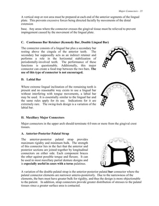Major Connectors - 35
A vertical stop or rest area must be prepared at each end of the anterior segments of the lingual
plate. This prevents excessive forces being directed facially by movements of the distal
extension
base. Any areas where the connector crosses the gingival tissue must be relieved to prevent
impingement caused by the movement of the lingual plate.
C. Continuous Bar Retainer (Kennedy Bar, Double Lingual Bar)
The connector consists of a lingual bar plus a secondary bar
resting above the cingula of the anterior teeth. The
secondary bar supposedly acts as an indirect retainer and
performs a role in the horizontal stabilization of
periodontally-involved teeth. The performance of these
functions is questionable. Additionally, this major
connector can create a food trap between the two bars. The
use of this type of connector is not encouraged.
D. Labial Bar
Where extreme lingual inclination of the remaining teeth is
present and no reasonable way exists to use a lingual bar
without interfering with tongue movements, a labial bar
may be used. It is essentially similar to the lingual bar and
the same rules apply for its use. Indications for it are
extremely rare. The swing-lock design is a variation of the
labial bar.
II. Maxillary Major Connectors
Major connectors in the upper arch should terminate 4.0 mm or more from the gingival crest
tissues.
A. Anterior-Posterior Palatal Strap
The anterior-posterior palatal strap provides
maximum rigidity and minimum bulk. The strength
of this connector lies in the fact that the anterior and
posterior sections are joined together by longitudinal
connectors on either side. Each component braces
the other against possible torque and flexure. It can
be used in most maxillary partial denture designs and
is especially useful in cases with a torus palatinus.
A variation of the double palatal strap is the anterior-posterior palatal bar connector where the
palatal connector elements are narrower anterio-posteriorly. Due to the narrowness of the
elements, the bars must have greater bulk for rigidity, and thus the design is more objectionable
to the patient. In addition, strap connectors provide greater distribution of stresses to the palatal
tissues since a greater surface area is contacted.
 