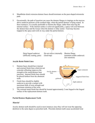 Denture Bases - 61
4. Mandibular distal extension denture bases should terminate on the pear-shaped retromolar
pads.
5. Occasionally, the path of insertion can cause the denture flanges to impinge on the mucosa
above undercut portions of the residual ridge, when the partial denture is being seated. In
these instances, it is usually preferable to shorten the flange, rather than relieving the
internal surface. If the internal surface is relieved significantly, a space will exist between
the denture base and the tissues when the denture is fully seated. Food may become
trapped in the space and work its way under the partial denture.
Deep lingual undercut Do not relieve internally Shorten flange
(difficulty seating, pain) (food trap) (maintain usable undercut)
(for retention)
Acrylic Resin Finish Lines
1. Denture bases should have internal
and external finish lines which do not
coincide (offsetting improves the
strength at the metal/denture base
junction). Internal finish lines should
be placed furthest from the abutment
teeth.
2. Finish lines should be slightly
undercut to provide a margin with
maximum bulk of resin strength and
maximum retention of the resin.
3. The external metal finish line should be located approximately 2 mm lingual to the lingual
surface of the replacement denture teeth.
Partial Denture Replacement Teeth
Material
Acrylic denture teeth should be used in most instances since they will not wear the opposing
dentition to the same degree as porcelain teeth. Porcelain denture teeth cause accelerated wear
 