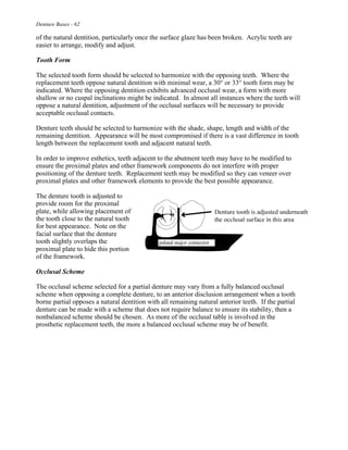 Denture Bases - 62
of the natural dentition, particularly once the surface glaze has been broken. Acrylic teeth are
easier to arrange, modify and adjust.
Tooth Form
The selected tooth form should be selected to harmonize with the opposing teeth. Where the
replacement teeth oppose natural dentition with minimal wear, a 30° or 33° tooth form may be
indicated. Where the opposing dentition exhibits advanced occlusal wear, a form with more
shallow or no cuspal inclinations might be indicated. In almost all instances where the teeth will
oppose a natural dentition, adjustment of the occlusal surfaces will be necessary to provide
acceptable occlusal contacts.
Denture teeth should be selected to harmonize with the shade, shape, length and width of the
remaining dentition. Appearance will be most compromised if there is a vast difference in tooth
length between the replacement tooth and adjacent natural teeth.
In order to improve esthetics, teeth adjacent to the abutment teeth may have to be modified to
ensure the proximal plates and other framework components do not interfere with proper
positioning of the denture teeth. Replacement teeth may be modified so they can veneer over
proximal plates and other framework elements to provide the best possible appearance.
The denture tooth is adjusted to
provide room for the proximal
plate, while allowing placement of
the tooth close to the natural tooth
for best appearance. Note on the
facial surface that the denture
tooth slightly overlaps the
proximal plate to hide this portion
of the framework.
Occlusal Scheme
The occlusal scheme selected for a partial denture may vary from a fully balanced occlusal
scheme when opposing a complete denture, to an anterior disclusion arrangement when a tooth
borne partial opposes a natural dentition with all remaining natural anterior teeth. If the partial
denture can be made with a scheme that does not require balance to ensure its stability, then a
nonbalanced scheme should be chosen. As more of the occlusal table is involved in the
prosthetic replacement teeth, the more a balanced occlusal scheme may be of benefit.
 
