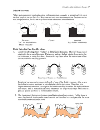 Principles of Partial Denture Design - 67
Minor Connectors
Where a cingulum rest is not adjacent an embrasure minor connector to an occlusal rest, cross
the free gingival margin directly – do not use an embrasure minor connector. Cover the entire
rest seat preparation, but do not wrap these minor connectors into embrasures.
Incorrect Correct Incorrect
Don’t use an embrasure Too far into embrasures
Minor connector
Distal Extension Case Considerations:
1. Use stress releasing direct retainers in distal extension cases. There are three axes of
rotation for these partial dentures. If abutment teeth are locked into the frameworks they
can be torqued in many directions. Stress-relieving clasps allow for some release of the
teeth to minimize torquing potential.
Three Axes of Rotation of a Partial Denture
Rotational movements increase with length of span of the distal extension. Also as arm
flexibility increases, resistance to lateral displaceability decreases. Therefore, it is
important to use maximum coverage of the edentulous ridge to reduce the degree of lateral
movement. This is particularly effective when there are large, broad ridges which tend to
provide greater resistance to horizontal movements.
2. The character of the mucoperiosteum can affect rotational movements. Flabby tissue is
more displaceable leading to increased rotation and therefore increased potential for stress
transference to the abutment teeth.
 