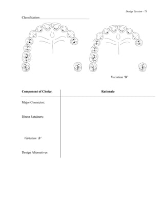 Design Session - 73
Classification
Variation ‘B’
Component of Choice Rationale
Major Connector:
Direct Retainers:
Variation ‘B’
Design Alternatives
 