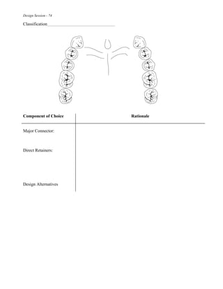 Design Session - 74
Classification
Component of Choice Rationale
Major Connector:
Direct Retainers:
Design Alternatives
 