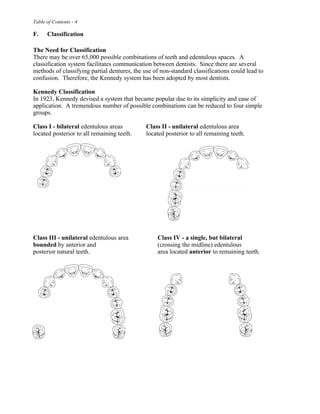 Table of Contents - 4
F. Classification
The Need for Classification
There may be over 65,000 possible combinations of teeth and edentulous spaces. A
classification system facilitates communication between dentists. Since there are several
methods of classifying partial dentures, the use of non-standard classifications could lead to
confusion. Therefore, the Kennedy system has been adopted by most dentists.
Kennedy Classification
In 1923, Kennedy devised a system that became popular due to its simplicity and ease of
application. A tremendous number of possible combinations can be reduced to four simple
groups.
Class I - bilateral edentulous areas Class II - unilateral edentulous area
located posterior to all remaining teeth. located posterior to all remaining teeth.
Class III - unilateral edentulous area Class IV - a single, but bilateral
bounded by anterior and (crossing the midline) edentulous
posterior natural teeth. area located anterior to remaining teeth.
 