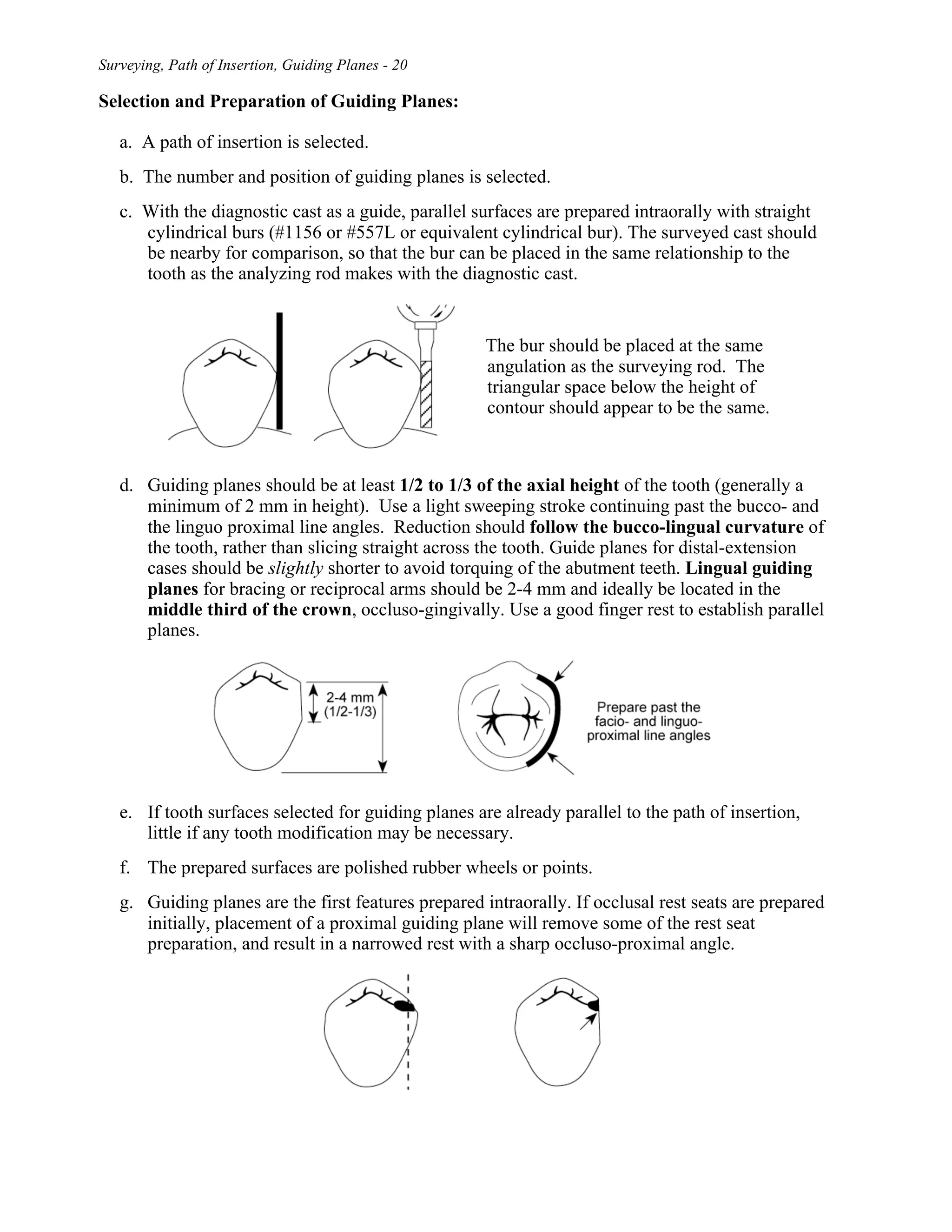 removable partial denture | PDF