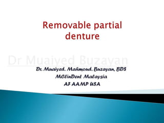 Rpd removable partial denture introduction 2nd yr