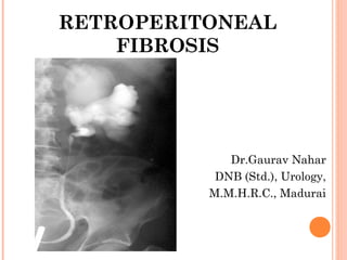 RETROPERITONEAL
FIBROSIS
Dr.Gaurav Nahar
DNB (Std.), Urology,
M.M.H.R.C., Madurai
 