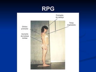 RPG 