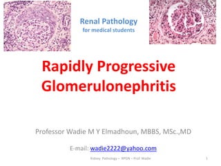 Renal Pathology
for medical students
Rapidly Progressive
Glomerulonephritis
Professor Wadie M Y Elmadhoun, MBBS, MSc.,MD
E-mail: wadie2222@yahoo.com
Kidney Pathology – RPGN – Prof. Wadie 1
 