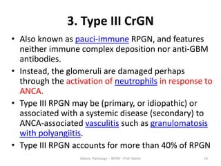 Rpgn Patterns Rapidly Progressive Glomerulonephritis - renal pathology- prof wadie | PPTX