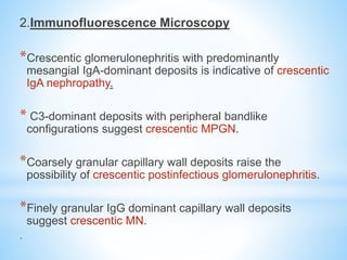 Crescentic Rpgn RAPIDLY PROGRESSIVE GLOMERULONEPHRITIS(RPGN) | PPTX