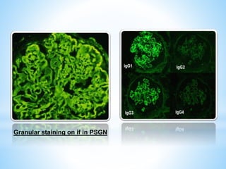 RAPIDLY PROGRESSIVE GLOMERULONEPHRITIS(RPGN) | PPTX