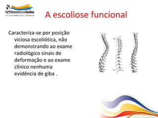 A escoliose funcional
Caracteriza-se por posição
  viciosa escoliótica, não
  demonstrando ao exame
  radiológico sinais de
  deformação e ao exame
  clínico nenhuma
  evidência de giba .
 