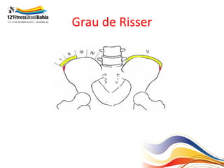 Grau de Risser
 