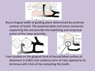 Bucco-lingual width of guiding plane determined by proximal
contour of tooth. The proximal plate and minor connector
supporting the rest provide the stabilizing and reciprocal
action of the clasp assembly.
I-bar located on the gingival third of buccal/labial surface of
abutment in 0.001 inch undercut.Arm of I-bar tapered to its
terminus with 2mm of tip contacting the tooth.
 