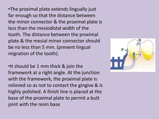 •The proximal plate extends lingually just
far enough so that the distance between
the minor connector & the proximal plate is
less than the mesiodistal width of the
tooth. The distance between the proximal
plate & the mesial minor connector should
be no less than 5 mm. (prevent lingual
migration of the tooth).
•It should be 1 mm thick & join the
framework at a right angle. At the junction
with the framework, the proximal plate is
relieved so as not to contact the gingiva & is
highly polished. A finish line is placed at the
base of the proximal plate to permit a butt
joint with the resin base
 