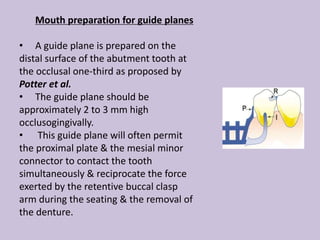 Mouth preparation for guide planes
• A guide plane is prepared on the
distal surface of the abutment tooth at
the occlusal one-third as proposed by
Potter et al.
• The guide plane should be
approximately 2 to 3 mm high
occlusogingivally.
• This guide plane will often permit
the proximal plate & the mesial minor
connector to contact the tooth
simultaneously & reciprocate the force
exerted by the retentive buccal clasp
arm during the seating & the removal of
the denture.
 