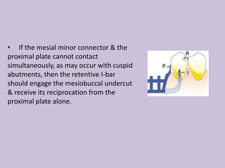 • If the mesial minor connector & the
proximal plate cannot contact
simultaneously, as may occur with cuspid
abutments, then the retentive I-bar
should engage the mesiobuccal undercut
& receive its reciprocation from the
proximal plate alone.
 