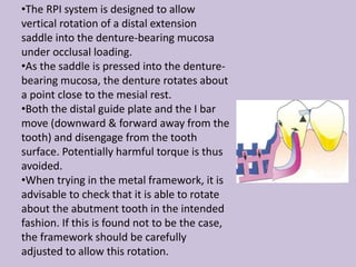 •The RPI system is designed to allow
vertical rotation of a distal extension
saddle into the denture-bearing mucosa
under occlusal loading.
•As the saddle is pressed into the denture-
bearing mucosa, the denture rotates about
a point close to the mesial rest.
•Both the distal guide plate and the I bar
move (downward & forward away from the
tooth) and disengage from the tooth
surface. Potentially harmful torque is thus
avoided.
•When trying in the metal framework, it is
advisable to check that it is able to rotate
about the abutment tooth in the intended
fashion. If this is found not to be the case,
the framework should be carefully
adjusted to allow this rotation.
 