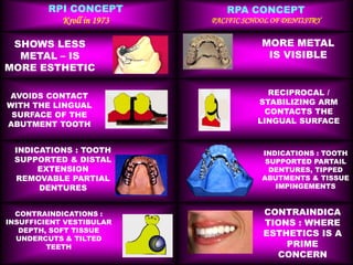 Reciprocal Tooth Rpi & rpa kk | PPTX