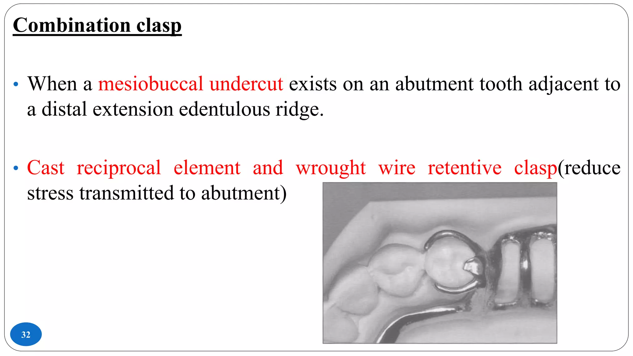 32
Combination clasp
• When a mesiobuccal undercut exists on an abutment tooth adjacent to
a distal extension edentulous ridge.
• Cast reciprocal element and wrought wire retentive clasp(reduce
stress transmitted to abutment)
 
