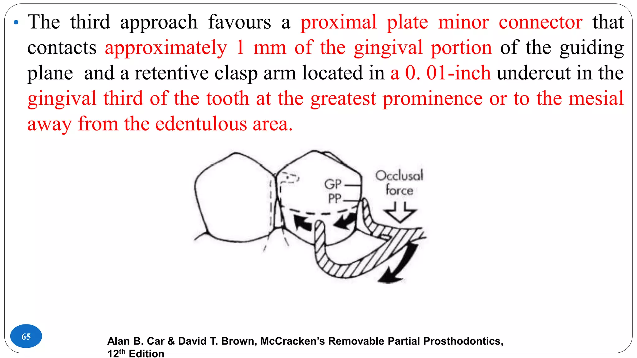 65
• The third approach favours a proximal plate minor connector that
contacts approximately 1 mm of the gingival portion of the guiding
plane and a retentive clasp arm located in a 0. 01-inch undercut in the
gingival third of the tooth at the greatest prominence or to the mesial
away from the edentulous area.
Alan B. Car & David T. Brown, McCracken’s Removable Partial Prosthodontics,
12th Edition
 