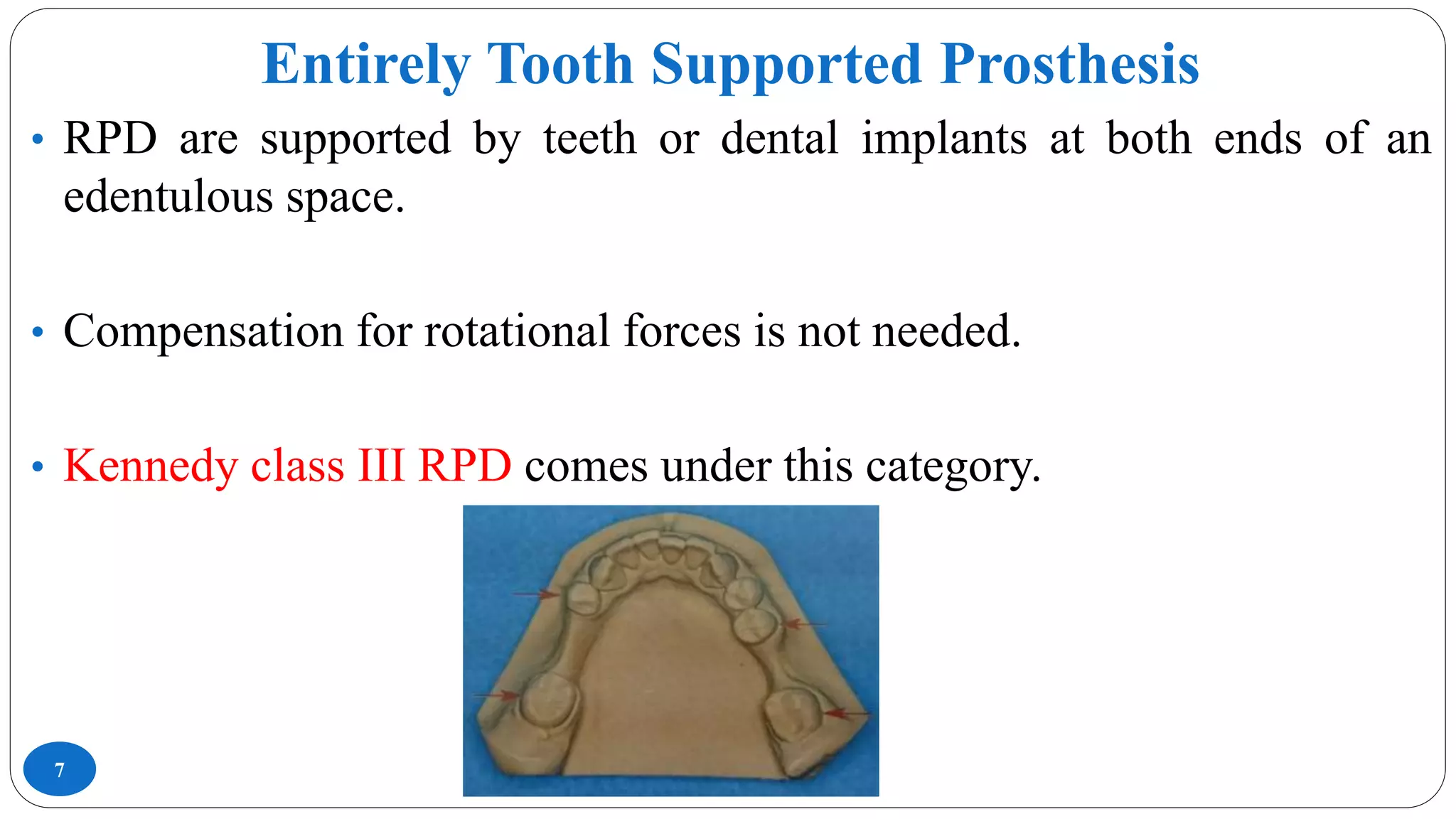 Entirely Tooth Supported Prosthesis
7
• RPD are supported by teeth or dental implants at both ends of an
edentulous space.
• Compensation for rotational forces is not needed.
• Kennedy class III RPD comes under this category.
 