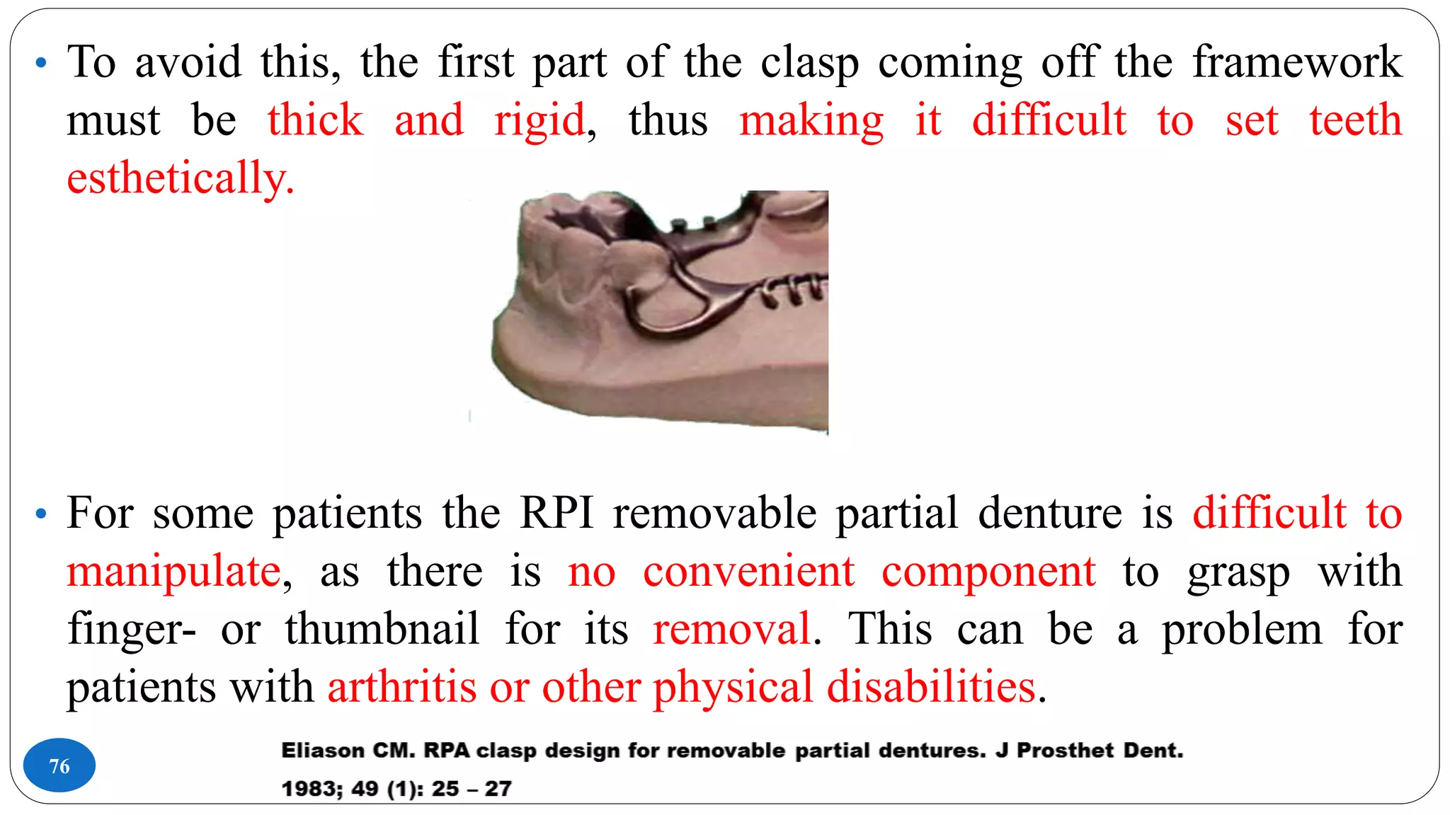76
• To avoid this, the first part of the clasp coming off the framework
must be thick and rigid, thus making it difficult to set teeth
esthetically.
• For some patients the RPI removable partial denture is difficult to
manipulate, as there is no convenient component to grasp with
finger- or thumbnail for its removal. This can be a problem for
patients with arthritis or other physical disabilities.
 