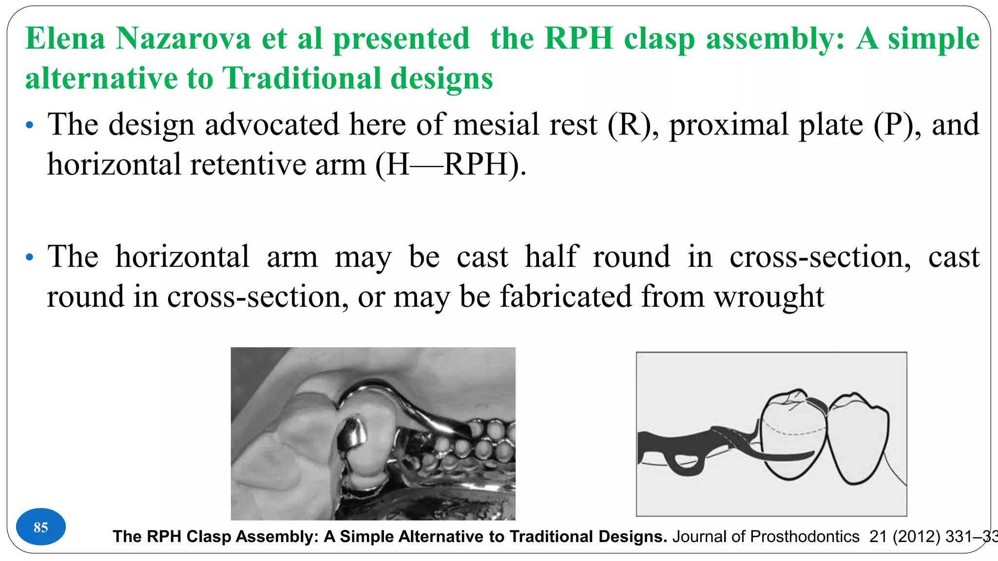 85
Elena Nazarova et al presented the RPH clasp assembly: A simple
alternative to Traditional designs
• The design advocated here of mesial rest (R), proximal plate (P), and
horizontal retentive arm (H—RPH).
• The horizontal arm may be cast half round in cross-section, cast
round in cross-section, or may be fabricated from wrought
The RPH Clasp Assembly: A Simple Alternative to Traditional Designs. Journal of Prosthodontics 21 (2012) 331–33
 