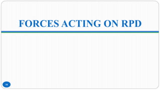 FORCES ACTING ON RPD
18
 