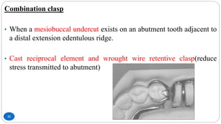 32
Combination clasp
• When a mesiobuccal undercut exists on an abutment tooth adjacent to
a distal extension edentulous ridge.
• Cast reciprocal element and wrought wire retentive clasp(reduce
stress transmitted to abutment)
 