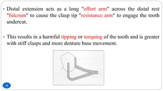 38
• Distal extension acts as a long "effort arm" across the distal rest
"fulcrum" to cause the clasp tip "resistance arm" to engage the tooth
undercut.
• This results in a harmful tipping or torquing of the tooth and is greater
with stiff clasps and more denture base movement.
 