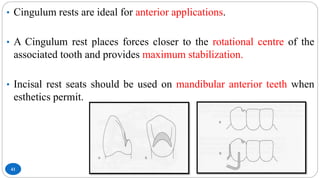 41
• Cingulum rests are ideal for anterior applications.
• A Cingulum rest places forces closer to the rotational centre of the
associated tooth and provides maximum stabilization.
• Incisal rest seats should be used on mandibular anterior teeth when
esthetics permit.
 