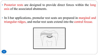42
• Posterior rests are designed to provide direct forces within the long
axis of the associated abutments.
• In I-bar applications, premolar rest seats are prepared in marginal and
triangular ridges, and molar rest seats extend into the central fossae.
 