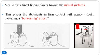 44
• Mesial rests direct tipping forces toward the mesial surfaces.
• This places the abutments in firm contact with adjacent teeth,
providing a "buttressing" effect.”
 