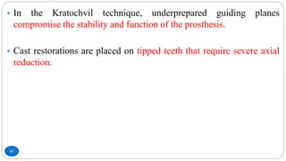 47
• In the Kratochvil technique, underprepared guiding planes
compromise the stability and function of the prosthesis.
• Cast restorations are placed on tipped teeth that require severe axial
reduction.
 