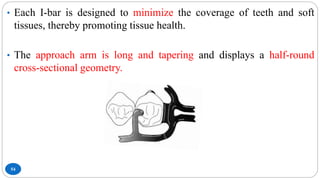 54
• Each I-bar is designed to minimize the coverage of teeth and soft
tissues, thereby promoting tissue health.
• The approach arm is long and tapering and displays a half-round
cross-sectional geometry.
 